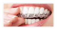 Zu den Ästhetischen Leistungen bei Zahnarzt Dr. med. dent. Armin Eisermann in Blaustein gehören auch die Korrektur kleiner Schönheitsfehler oder Fehlstellungen der Zähne.